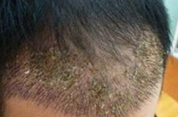 种头发多少钱，10元左右一根！