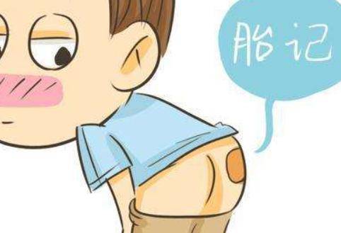 胎记是怎么形成的