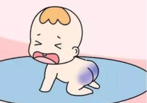 胎记是怎么形成的