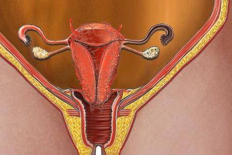 子宫内膜薄怎么调理恢复快一点 女性须知是什么原因造成