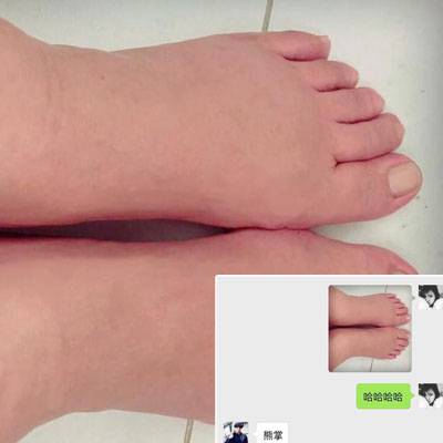 伊能静怀孕晒大肚子照片 临产脚肿如熊掌