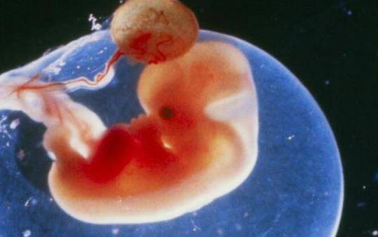 怀孕一个月的症状有哪些表现 孕一月孕妈妈注意事项