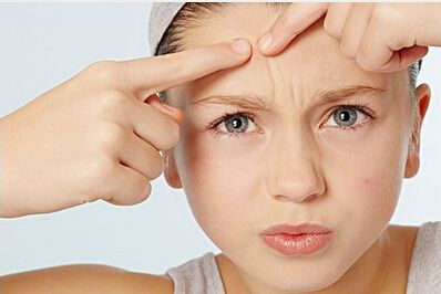 苦恼痘疤怎么去除？这些方法能帮到你