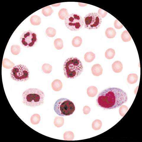 中性粒细胞偏低偏高各是怎么回事呢