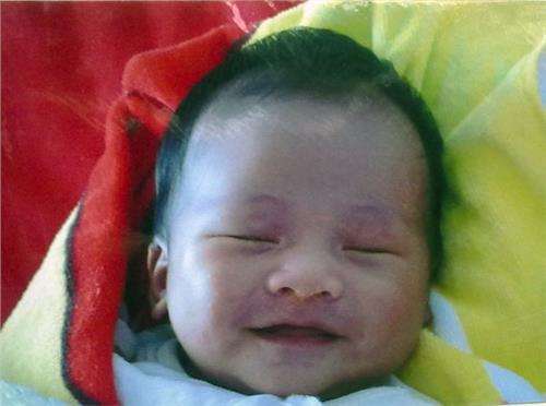 巧克力囊肿严重吗 巧克力囊肿患者的饮食保健