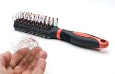 头发掉的很厉害怎么办 教你方法妙解决