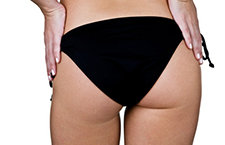 痔疮的最佳治疗偏方 简单又有效