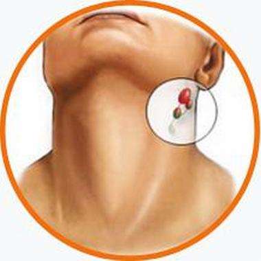 颈部淋巴 恶性肿瘤是颈部淋巴结肿大原因之一