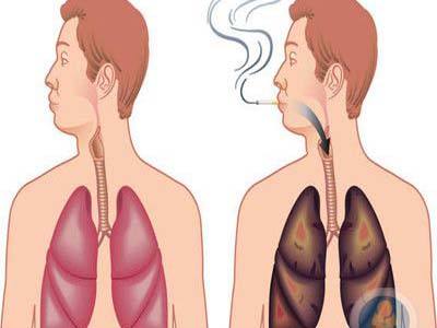 懂得疾病预防知识 才能更好的养生保健