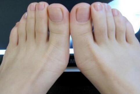 怎么样治脚气的方法及16个偏方供你挑选