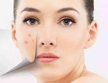 怎么治疗痘疤 正确的饮食及作息规律很重要