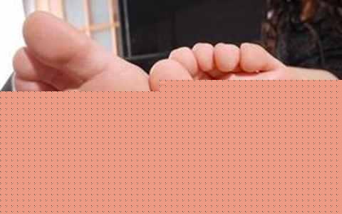 脚气也是病得治 如何治疗脚气