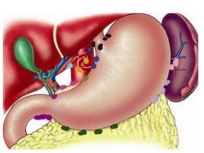 肝胆疾病 胆囊炎的症状及治疗你了解吗