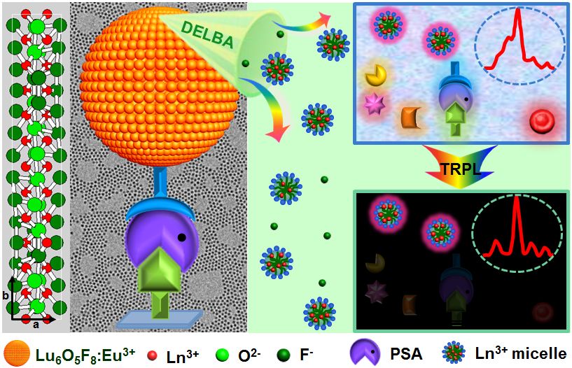 前列腺特异性抗原 前列腺诊断的重要指标
