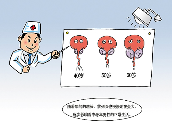 常见的前列腺疾病 前列腺肥大