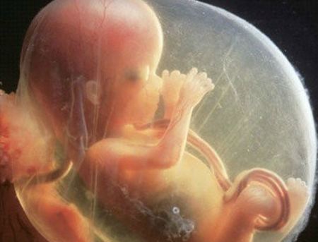 怀孕8个月胎儿图 胎儿图能够清楚的了解胎儿的发育状况