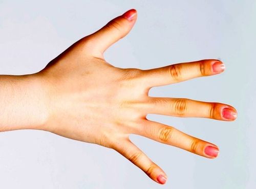 4种皮肌炎的症状及皮肌炎的护理的介绍