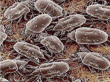 螨虫的危害 螨虫虽然肉眼无法看见但也不能忽视