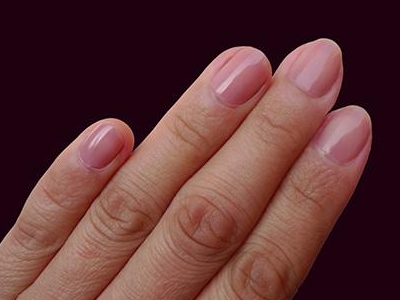 导致我们大拇指指甲上有竖纹的原因是什么