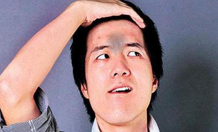 印堂发黑不是儿戏，该重视