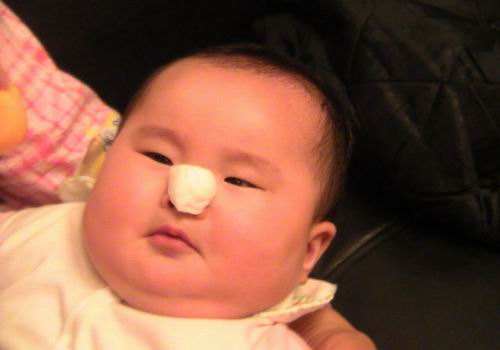 小儿感冒鼻塞怎么办