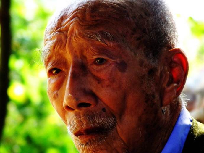 如何抑制老年斑的饮食建议