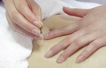 告诉你针灸减肥副作用有哪些