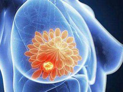 乳腺增生怎么办