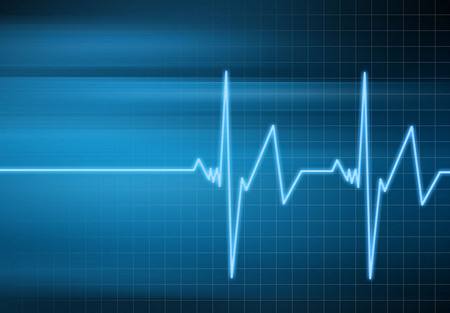 心率过快的原因