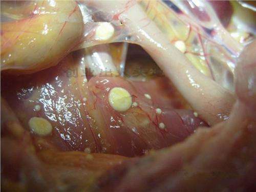 顽固的妇科疾病 霉菌性阴炎怎么根治