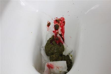 大便出血怎么办 几种食疗方法供你选择