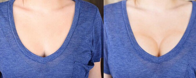 这样也可以 不用动刀塑造丰满胸部效果