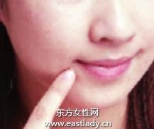 粉刺、痘痘肌肤的化妆技巧