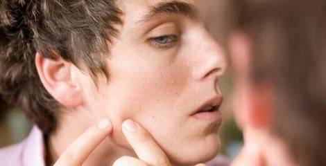 如何清除粉刺 粉刺和痘痘又有什么区别