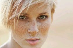 雀斑是怎么形成的 不花钱的雀斑去除方法推荐