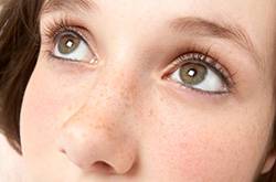 如何有效去除色斑黄褐斑