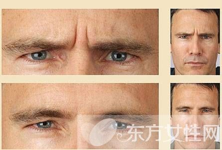 怎样消除眉间皱纹 四大方法任你选择