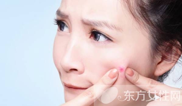 粉刺和痘痘的区别 这么做可以有效预防青春痘哦