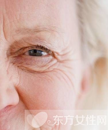 如何去眼部细纹 几招赶跑鱼尾纹