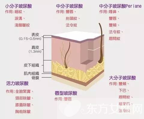 你知道注射玻尿酸需要多少钱吗