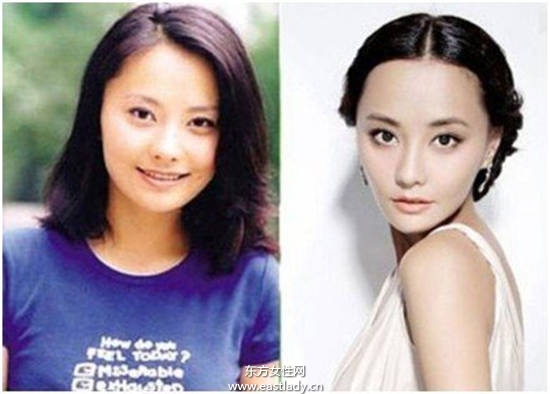 吴奇隆前妻马雅舒被曝整形前像王宝强