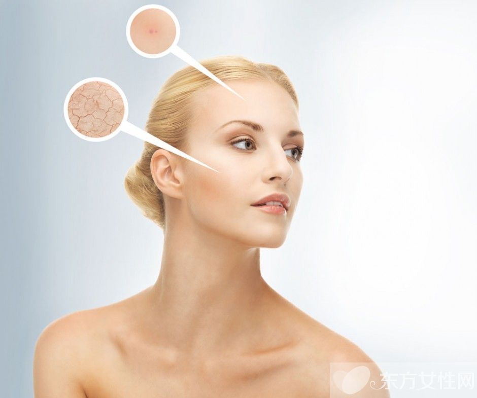 怎样去眼袋最有效 6招教你如何预防眼袋