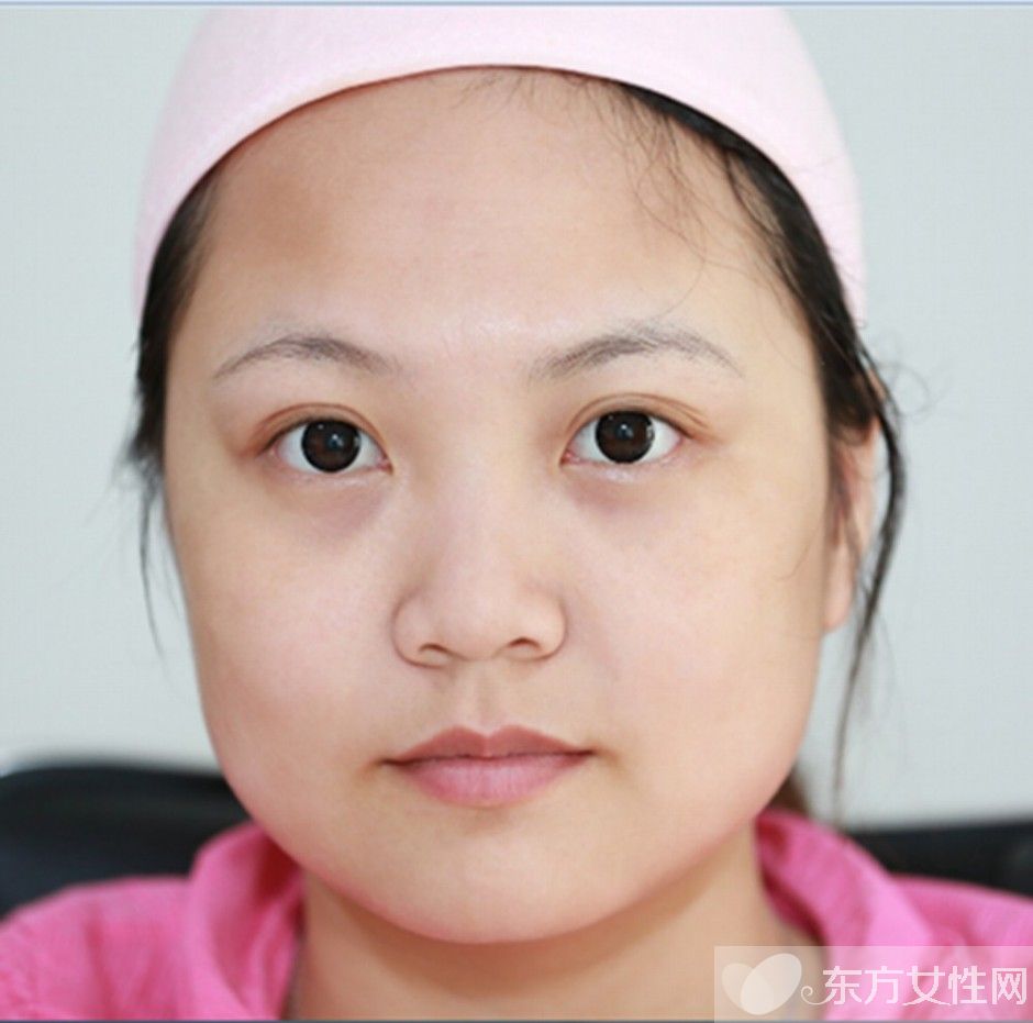 怎么去黑眼圈和眼袋 消除黑眼圈眼袋这么做就够了