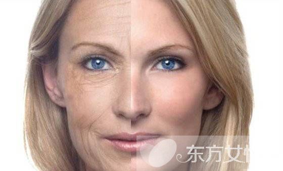 女人怎么做不易长皱纹 这些地方长皱纹谨防疾病