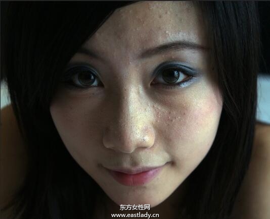 五个简单小妙招 让你跟青春痘疤痕say goodbye