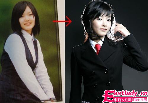 韩彩英整容前后对比照片