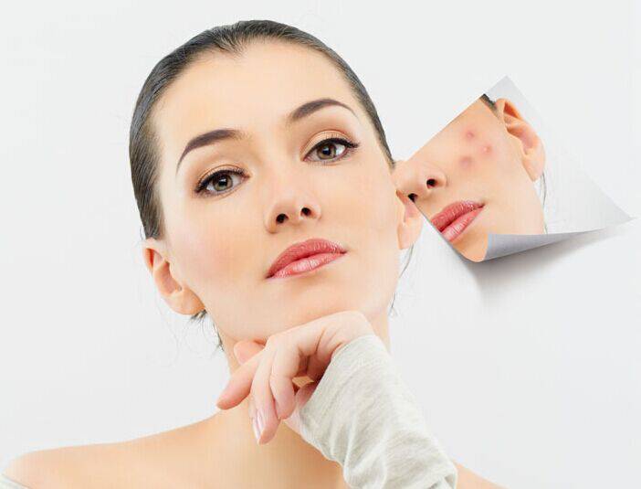 激光祛痘有好有坏 揭密你所不知的副作用