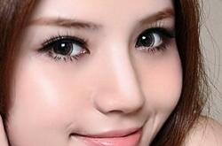 眼袋大怎么办呢 专家教你该如何去除大眼袋