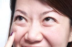 怎么去黑眼圈和眼袋 消除黑眼圈眼袋这么做就够了