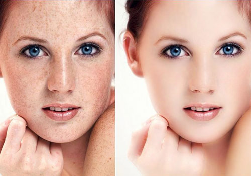 祈颜流金岁月助你轻松下 斑 无需美颜